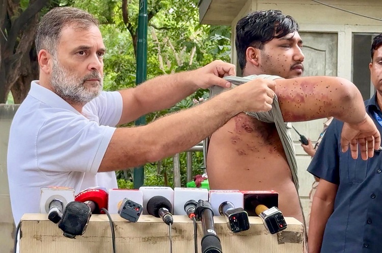 Rahul Gandhi accuses Centre of ‘lying’ on pellet use during CJP stir