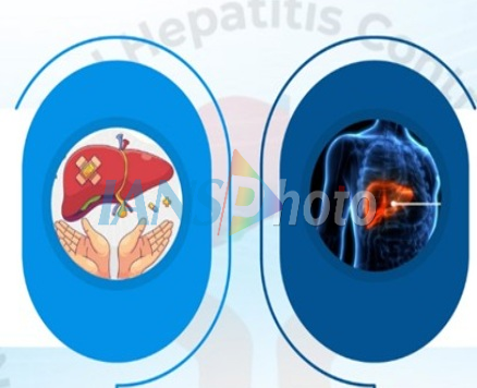 India doubles down on hepatitis prevention drive with free testing, integrated services